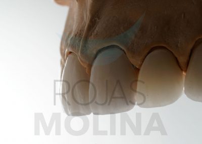 funcional-17