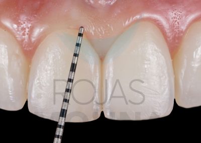 periodoncia-1