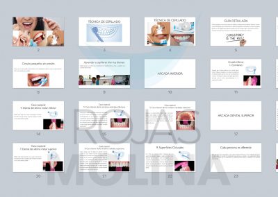 periodoncia-10