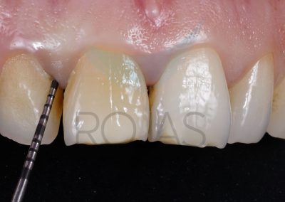 periodoncia-2