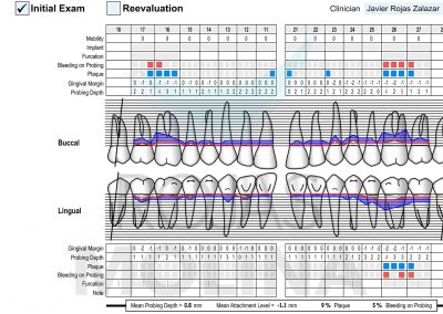 periodoncia-5