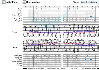 periodoncia-7