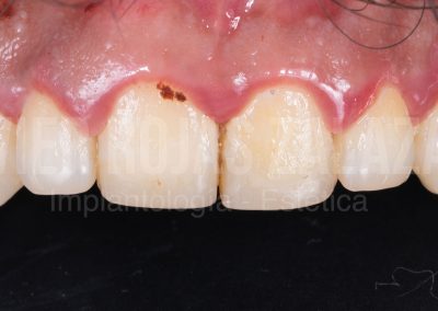 periodoncia1-1