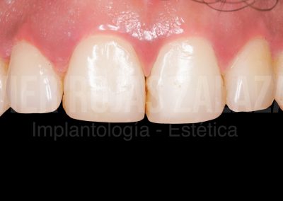 periodoncia1-2