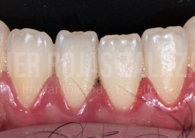 periodoncia1-3