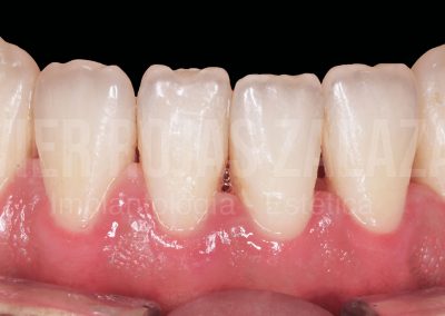 periodoncia1-4