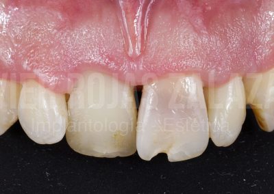 periodoncia1-6