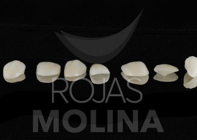 rehabilitacion2-7